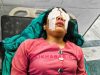 शिक्षक आन्दोलनमा घाइते भएकी पत्रकार सविना कार्कीको आँखामा समस्या