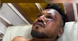 भारतमा भयावह विमान दुर्घटना, २४१ जनाको मृत्यु, एकजना यात्रु जीवितै उद्धार